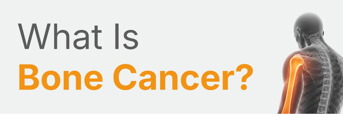 Bone Cancer: Early Signs, Symptoms, and When to See a Doctor
